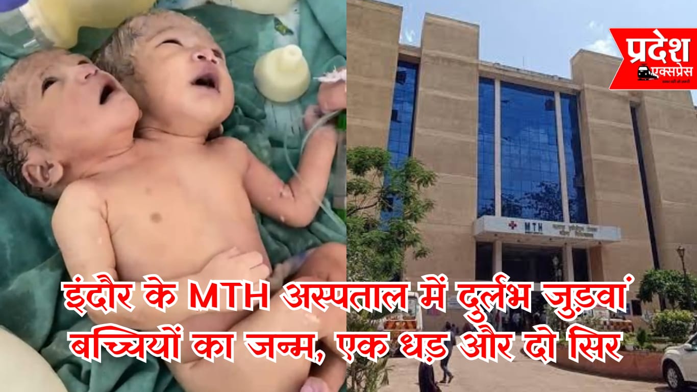 इंदौर के MTH अस्पताल में दुर्लभ जुड़वां बच्चियों का जन्म, एक धड़ और दो सिर: डॉक्टरों ने किया जटिल सिजेरियन ऑपरेशन सफल